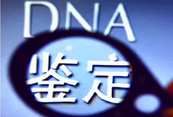张掖妇保院可以做DNA鉴定吗，张掖第二人民医院做亲子鉴定办理流程